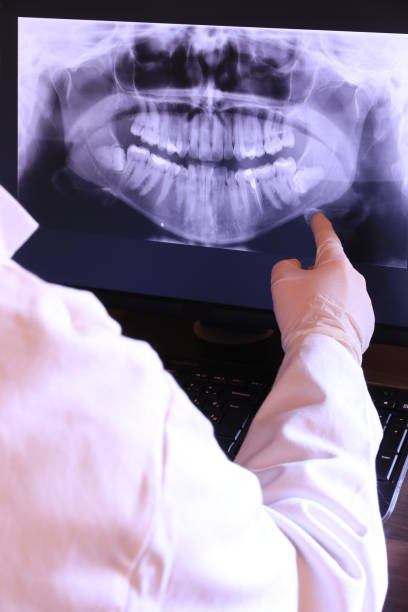 Best Root Canal Emergency Dentist  in Streetsboro, OH