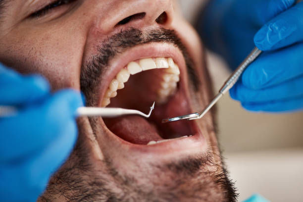 Best Broken Tooth Emergency  in Streetsboro, OH